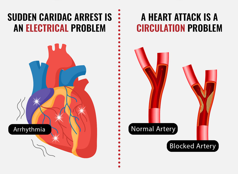 Heart graphic showing a sudden cardiac arrest and a heart attack. 